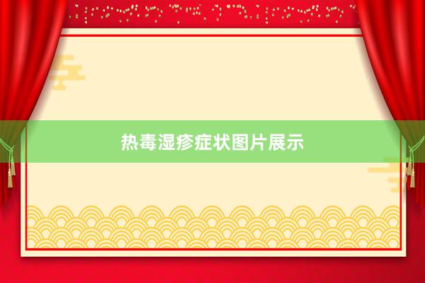 热毒湿疹症状图片展示